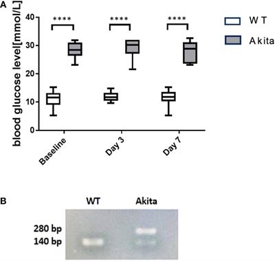 The association between altered intestinal microbiome, impaired systemic and ocular surface immunity, and impaired wound healing response after corneal alkaline-chemical injury in diabetic mice